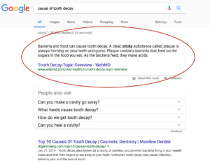 example of a featured snippet for a dental website